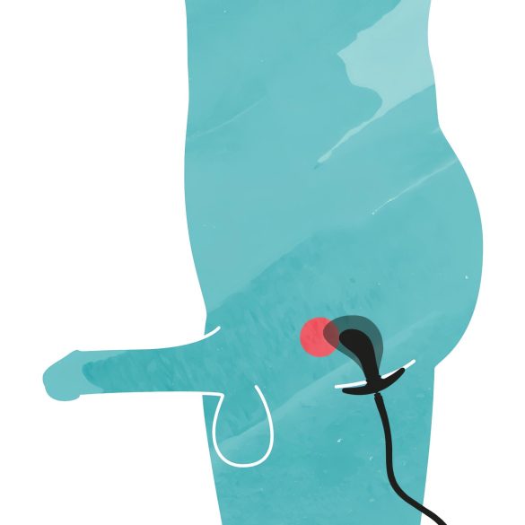 You2Toys - Inflatable Anal Expander Plug (Black)