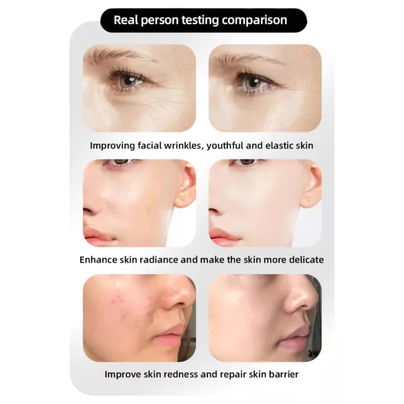 Photon Rejuvenation LED Facial Mask